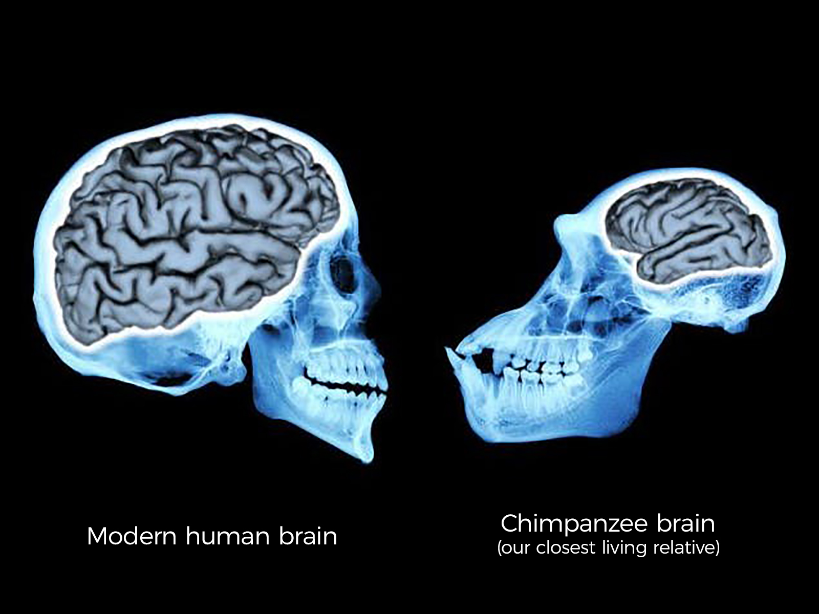 Human and Chimp Brains